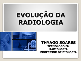 EVOLUÇÃO DA
RADIOLOGIA
THYAGO SOARES
TECNÓLOGO EM
RADIOLOGIA
PROFESSOR DE BIOLOGIA
 