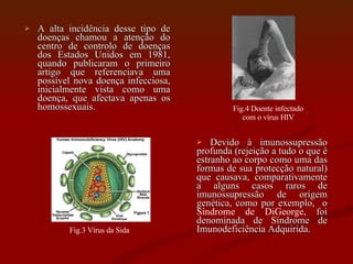 A alta incidência desse tipo de doenças chamou a atenção do centro de controlo de doenças dos Estados Unidos em 1981, quando publicaram o primeiro artigo que referenciava uma possível nova doença infecciosa, inicialmente vista como uma doença, que afectava apenas os homossexuais. Devido à imunossupressão profunda (rejeição a tudo o que é estranho ao corpo como uma das formas de sua protecção natural) que causava, comparativamente a alguns casos raros de imunossupressão de origem genética, como por exemplo,  o  Síndrome de DiGeorge , foi denominada de Síndrome de Imunodeficiência Adquirida. Fig.3 Vírus da Sida Fig.4 Doente infectado com o vírus HIV 