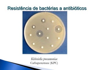 Resistência de bactérias a antibióticos
Klebsiella pneumoniae
Carbapenemase (KPC)
 
