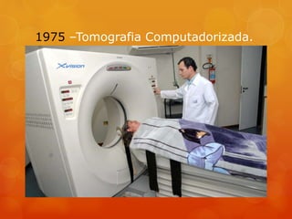1975 –Tomografia Computadorizada.
 