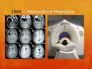 1986 – Ressonância Magnetica.
 