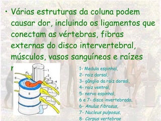 Várias estruturas da coluna podem causar dor, incluindo os ligamentos que conectam as vértebras, fibras externas do disco intervertebral, músculos, vasos sanguíneos e raízes nervosas. 1- Medula espinhal,  2- raiz dorsal,  3- gânglio da raiz dorsal,  4- raiz ventral,  5- nervo espinhal,  6 e 7- disco invertebrado,  6-  Anulus fibrosus ,  7-  Nucleus pulposus , 8-  Corpus vertebrae 