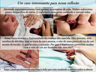 Um caso interessante para nossa reflexão
https://padrepauloricardo.org/blog/o-bebe-que-esta-mudando-o-debate-sobre-o-aborto
Abortado espontaneamente com apenas 19 semanas de vida, Walter sobreviveu
pouco tempo fora do útero. O suficiente para gerar comoção e marcar vidas.
Essas fotos revelam a humanidade da criança não nascida. Elas provam, sem
sombra de dúvidas, que se trata de uma pessoa, e não de uma partícula ou de um
monte de tecido. O que levanta a questão: Por que é legalmente permitido acabar
com a vida de um ser humano não nascido?
 