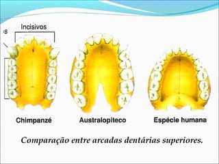 Comparação entre arcadas dentárias superiores.

 