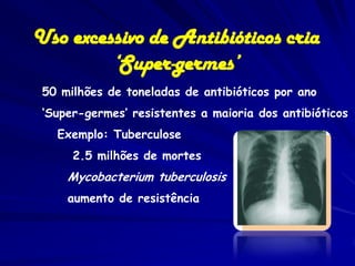 Uso excessivo de Antibióticos cria
         ‘Super-germes’
 50 milhões de toneladas de antibióticos por ano
 ‘Super-germes’ resistentes a maioria dos antibióticos
   Exemplo: Tuberculose
      2.5 milhões de mortes
     Mycobacterium tuberculosis
     aumento de resistência
 
