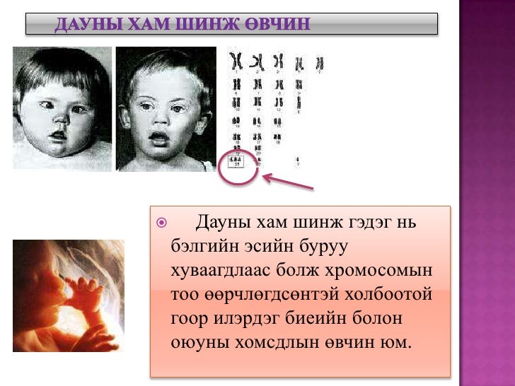 Evolution