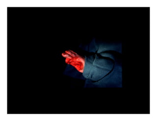Picture of Evolution of limb salvage technics & where they are going: From ...