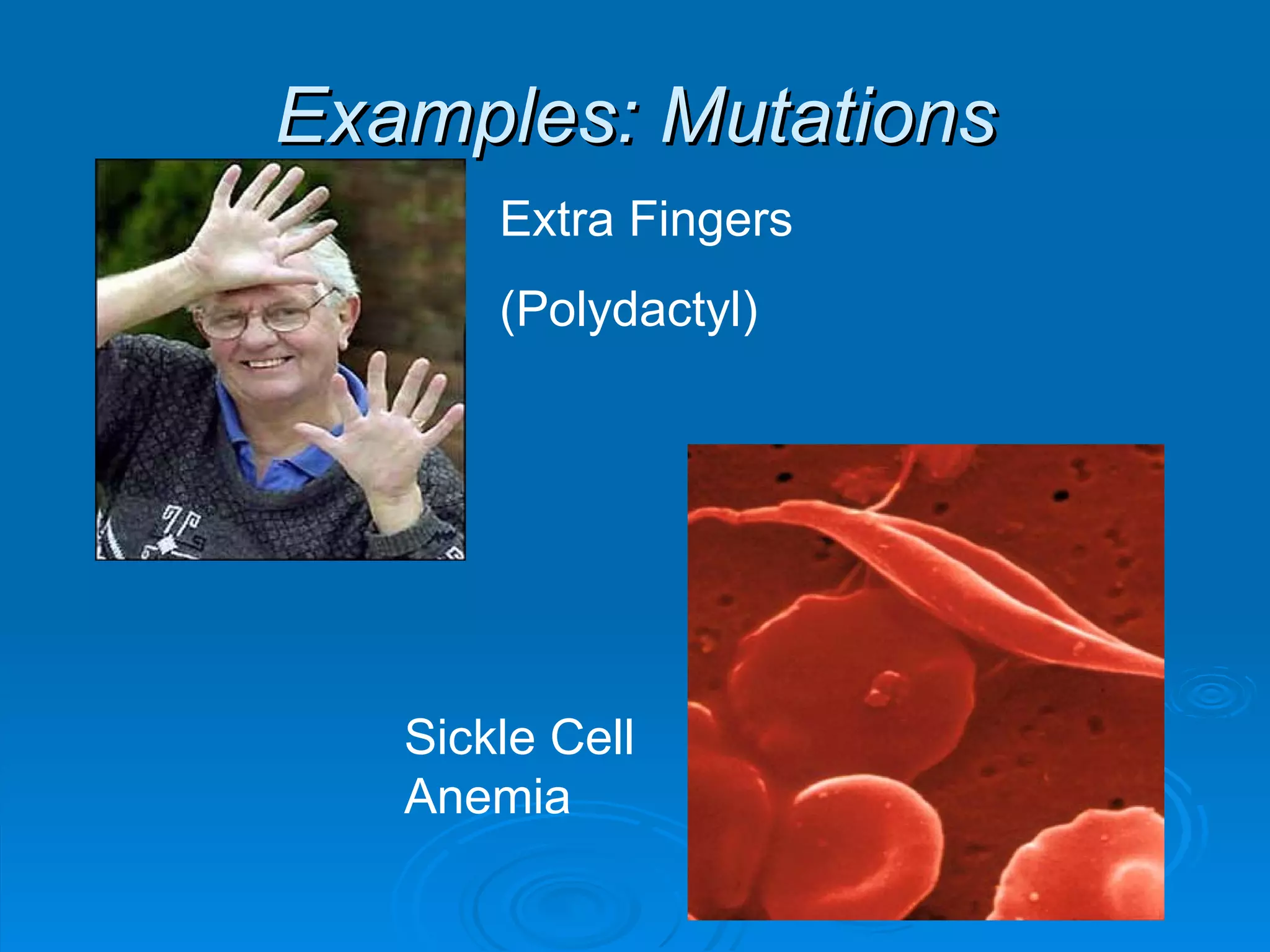 Examples: Mutations Extra Fingers (Polydactyl) Sickle Cell Anemia 