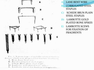 A) LANE BENT WIRE
B) CORRUGATED STEEL
STAPLES
C) SCHEDE BRUN PLAIN
STEEL STAPLES
D) LAMBOTTE GOLD
PLATED BONE SPIKES
E) LAMBOTTE SCEWS
FOR FIXATION OF
FRAGMENTS
 