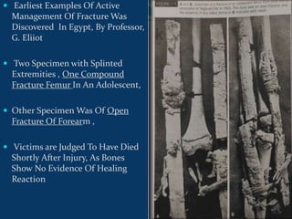  Earliest Examples Of Active
Management Of Fracture Was
Discovered In Egypt, By Professor,
G. Eliiot
 Two Specimen with Splinted
Extremities , One Compound
Fracture Femur In An Adolescent,
 Other Specimen Was Of Open
Fracture Of Forearm ,
 Victims are Judged To Have Died
Shortly After Injury, As Bones
Show No Evidence Of Healing
Reaction
 