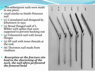  The subsequent nails were made
in one piece:
 1)nail similar to Smith-Petersen
nail
 (2) Cannulated nail designed by
Johansson in 1932
 (3) Broad flanged nail of L.
Bôhler with spikes that were
supposed to prevent backing-out
 (4) Felsenreich nail with broad
flanges
 (5) SP-nail with inner threads at
the end;
 (6) Thornton nail made from
vitallium
 Resorption at the fracture site
lead to the shortening of the
neck, the nail often perforated
the femoral head
 