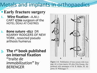 Metals and implants in orthopaedics
 Early fracture surgery
1. Wire fixation –A.M.I-
CART 1770s surgeon of the
HOTEL DEAU AT CASTRES
2. Bone suture -1827 DR
KEARNY RODGERS OF NEW
YORK , resected pseudo
arthosis humerus
3. The 1st book published
on internal fixation
“traite de
immobilization” by
BERENGER
 