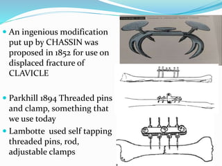  An ingenious modification
put up by CHASSIN was
proposed in 1852 for use on
displaced fracture of
CLAVICLE
 Parkhill 1894 Threaded pins
and clamp, something that
we use today
 Lambotte used self tapping
threaded pins, rod,
adjustable clamps
 