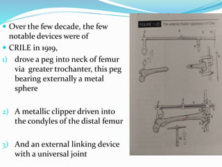  Over the few decade, the few
notable devices were of
 CRILE in 1919,
1) drove a peg into neck of femur
via greater trochanter, this peg
bearing externally a metal
sphere
2) A metallic clipper driven into
the condyles of the distal femur
3) And an external linking device
with a universal joint
 