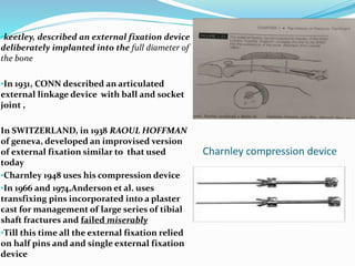 Charnley compression device
•keetley, described an external fixation device
deliberately implanted into the full diameter of
the bone
•In 1931, CONN described an articulated
external linkage device with ball and socket
joint ,
In SWITZERLAND, in 1938 RAOUL HOFFMAN
of geneva, developed an improvised version
of external fixation similar to that used
today
•Charnley 1948 uses his compression device
•In 1966 and 1974,Anderson et al. uses
transfixing pins incorporated into a plaster
cast for management of large series of tibial
shaft fractures and failed miserably
•Till this time all the external fixation relied
on half pins and and single external fixation
device
 