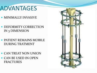 ADVANTAGES
 MINIMALLY INVASIVE
 DEFORMITY CORRECTION
IN 3 DIMENSION
 PATIENT REMAINS MOBILE
DURING TRATMENT
 CAN TREAT NON UNION
 CAN BE USED IN OPEN
FRACTURES
 