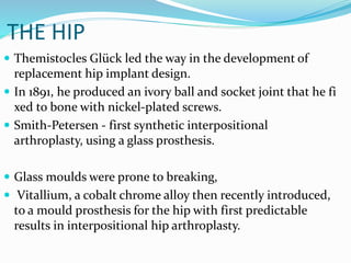 THE HIP
 Themistocles Glück led the way in the development of
replacement hip implant design.
 In 1891, he produced an ivory ball and socket joint that he fi
xed to bone with nickel-plated screws.
 Smith-Petersen - first synthetic interpositional
arthroplasty, using a glass prosthesis.
 Glass moulds were prone to breaking,
 Vitallium, a cobalt chrome alloy then recently introduced,
to a mould prosthesis for the hip with first predictable
results in interpositional hip arthroplasty.
 
