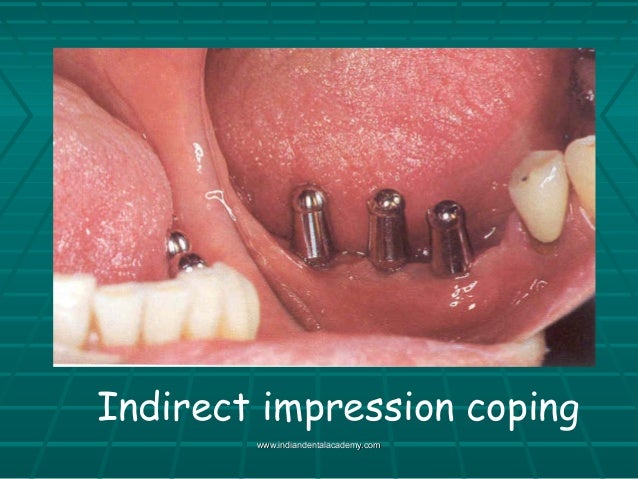 astra impression coping astra impression coping