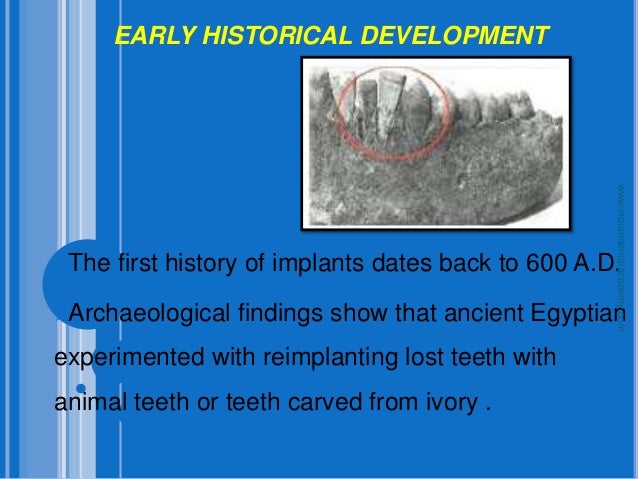 an introduction to the history and practice of prosthetic surgery The clinical guideline on erectile dysfunction history may reveal causes or comorbidities such as penile prosthetic surgery under local anesthesia j urol. an introduction to the history and practice of prosthetic surgery The clinical guideline on erectile dysfunction history may reveal causes or comorbidities such as penile prosthetic surgery under local anesthesia j urol.