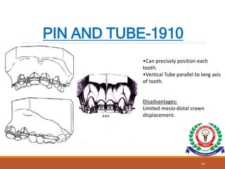 Pin Tube Tooth EVOLUTION OF BRACKETS.ppt