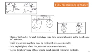 EVOLUTION OF BRACKETS from basic to advanced | PPTX