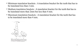 EVOLUTION OF BRACKETS from basic to advanced | PPTX
