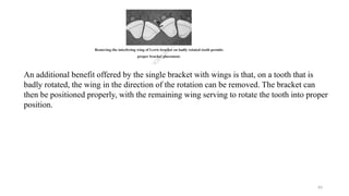 EVOLUTION OF BRACKETS from basic to advanced | PPTX
