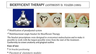EVOLUTION OF BRACKETS from basic to advanced | PPTX