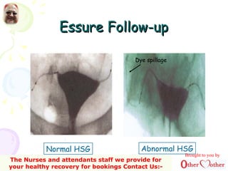 Essure Follow-upEssure Follow-up
Normal HSG Abnormal HSG
Dye spillage
Brought to you by
The Nurses and attendants staff we provide for
your healthy recovery for bookings Contact Us:-
 