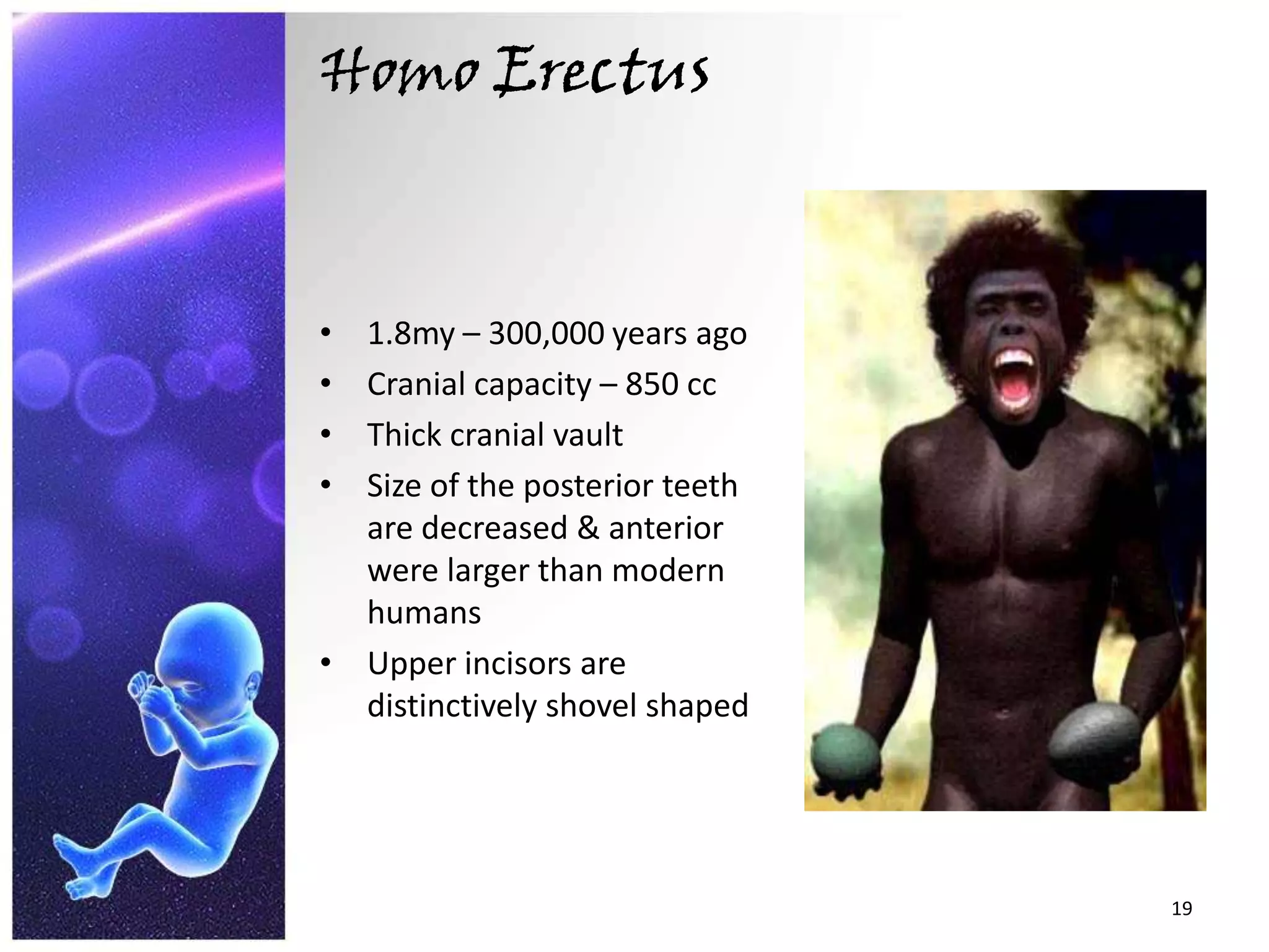 Homo Erectus1.8my – 300,000 years agoCranial capacity – 850 ccThick cranial vaultSize of the posterior teeth are decreased & anterior were larger than modern humansUpper incisors are distinctively shovel shaped19
