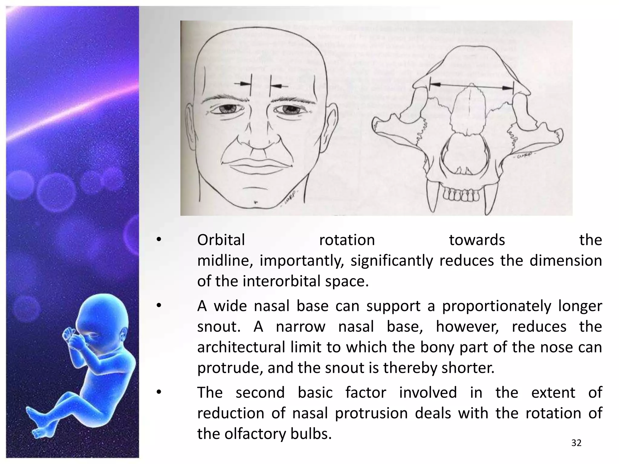 The eyes come closer together.Orbital rotation towards the midline, importantly, significantly reduces the dimension of the interorbital space.A wide nasal base can support a proportionately longer snout. A narrow nasal base, however, reduces the architectural limit to which the bony part of the nose can protrude, and the snout is thereby shorter.The second basic factor involved in the extent of reduction of nasal protrusion deals with the rotation of the olfactory bulbs.32