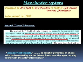 Manchester system
Developed by M.C.Todd & W.J.Meredith in 1938 in Holt Radium
Institute ,Manchester
Later revised in 1953

Normal Tissue Tolerance :

“ paracervical triangle," ……… as roughly pyramidal in shape,
with its base resting on the lateral fornix and the apex curving
round with the anteverted uterus ”

 