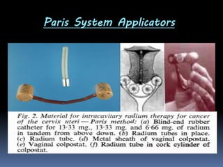 Paris System Applicators

 