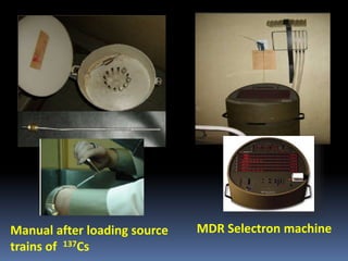 Manual after loading source
trains of 137Cs

MDR Selectron machine

 