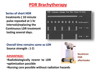 PDR Brachytherapy
Series of short HDR
treatments ( 10 minute
pulse repeated at 1 hr
intervals)replacing the
Continuous LDR treatment
lasting several days.

Overall time remains same as LDR
Source strength : 1 Ci
ADVANTAGE:
•Radiobiologically nearer to LDR
•optimization possible
•Nursing care possible without radiation hazards

Nucletron
PDR
afterloader

 