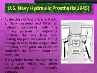 U.S. Navy Hydraulic Prosthesis(1945)
• At the close of World War II, the U.
S. Navy designed and fitted an
hydraulic prosthesis with the
primary purpose of improving
function. The very large ball-
bearing hip joint was made strong
enough to bear all the weight, thus
obtaining a free joint. An extension
controlled the motion about the
knee joint.
• The cylinder in turn was controlled
by a valve which was either
automatically or manually
actuated.
 