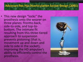 Advances flex Hip Disarticulation Socket Design (2001)
• This new design “locks” the
prosthesis onto the wearer on
three planes: frontto-back,
side-to-side, and top-to-
bottom. The intimate fit
resulting from this three-tiered
approach to suspension
prevents pistoning (that is,
movement up and down and
side to side in the socket),
improving the HD amputee’s
ability to efficiently control the
prosthesis.
 