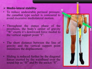  Medio-lateral stability-
• To reduce undesirable perineal pressure,
the canadian type socket is contoured to
avoid excessive mediolateral motion.
• Throughout the stance phase of the
prosthesis, the body’s center of gravity
“W” exerts it’s downward force medial to
the vertical support point “I”.
• The short distance between the line of
gravity and the vertical support point
minimizes the displacement.
• Sliding is reduced further by the diagonal
forces exerted by the waistband over the
sound hip as “H” and by the socket “S”.
I
W
H
S
I
 