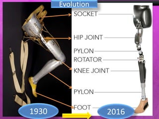 Evolution
1930 2016
 