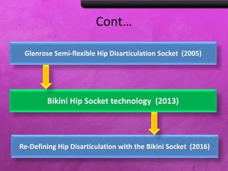 Cont…
Bikini Hip Socket technology (2013)
Re-Defining Hip Disarticulation with the Bikini Socket (2016)
Glenrose Semi-flexible Hip Disarticulation Socket (2005)
 