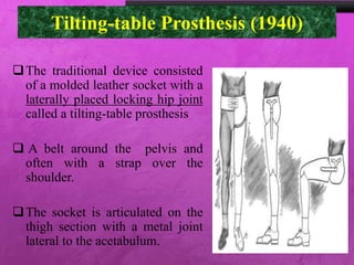 Tilting-table Prosthesis (1940)
The traditional device consisted
of a molded leather socket with a
laterally placed locking hip joint
called a tilting-table prosthesis
 A belt around the pelvis and
often with a strap over the
shoulder.
The socket is articulated on the
thigh section with a metal joint
lateral to the acetabulum.
 