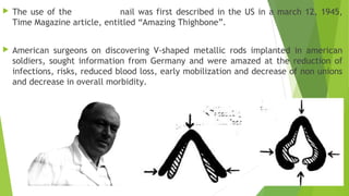  The use of the nail was first described in the US in a march 12, 1945,
Time Magazine article, entitled “Amazing Thighbone”.
 American surgeons on discovering V-shaped metallic rods implanted in american
soldiers, sought information from Germany and were amazed at the reduction of
infections, risks, reduced blood loss, early mobilization and decrease of non unions
and decrease in overall morbidity.
 