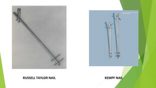 RUSSELL TAYLOR NAIL KEMPF NAIL
 