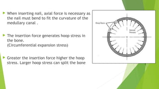  When inserting nail, axial force is necessary as
the nail must bend to fit the curvature of the
medullary canal .
 The insertion force generates hoop stress in
the bone.
(Circumferential expansion stress)
 Greater the insertion force higher the hoop
stress. Larger hoop stress can split the bone
 