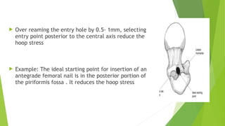  Over reaming the entry hole by 0.5- 1mm, selecting
entry point posterior to the central axis reduce the
hoop stress
 Example: The ideal starting point for insertion of an
antegrade femoral nail is in the posterior portion of
the piriformis fossa . It reduces the hoop stress
 