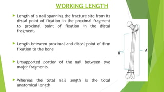 WORKING LENGTH
 Length of a nail spanning the fracture site from its
distal point of fixation in the proximal fragment
to proximal point of fixation in the distal
fragment.
 Length between proximal and distal point of firm
fixation to the bone
 Unsupported portion of the nail between two
major fragments
 Whereas the total nail length is the total
anatomical length.
 