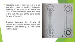  Medullary canal is more or less like an
hour-glass than a perfect cylinder.
Reaming is an attempt to make the
canal of uniform size to adapt the bone
to the nail. The size of the canal limits
the size of the nail.
 Reaming improves the length of
contact, reduces the working length and
increases the stability of the ‘tube
within a tube’
 