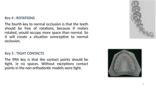 Tooth Contact Exceptions evolution of preadjusted edgewise bracket | PPTX