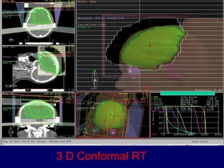 EVOLUTION OF RADIATION IN CANCER TREATMENT | PPT