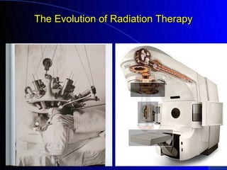 The Evolution of Radiation Therapy
 